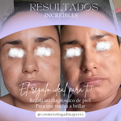 Cosmetologa Dina Pérez